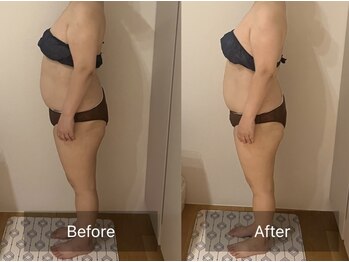 ヨサパーク こらっしぇ御徒町店(YOSA PARK)/お腹周りを得意とする施術