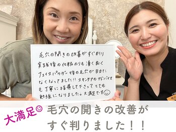 メモリ/お客様のご感想/毛穴ケア