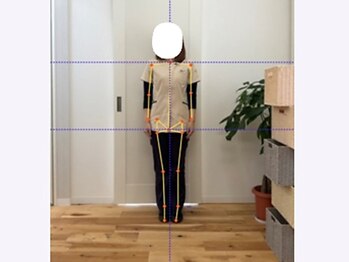 しのまる整体の写真/AI姿勢分析であなた専用の施術計画☆“しのまる整体”で猫背や骨盤の歪みを改善しよう！