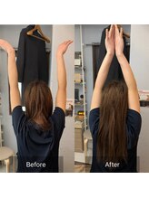 ライトワーク 西新宿店/1回で肩の挙上制限をとる魔法