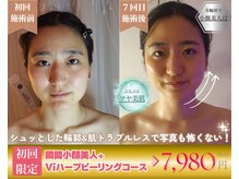 ビューティー アンド ハピネス 天神(Beauty&Happiness)の雰囲気（結果重視の集中ケアで回数を重ねる度に周りに褒められるお声多数）
