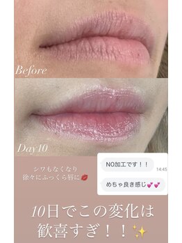 ミューズ(MUSE)/最新施術【ローマピンク】