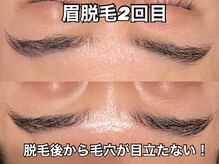 リエル(RIEL)/【眉脱毛】