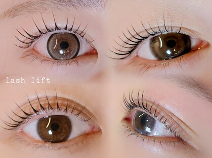 ピピ(pipi)の写真