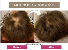 リアン(Re-Ane)/お客様の声