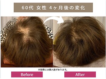 リアン(Re-Ane)/お客様の声