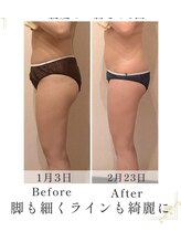 ミネット(Minett)/