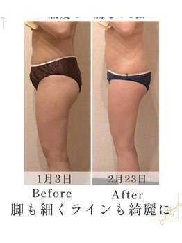 ミネット(Minett)/