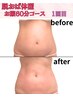 脱おば体型!【ぽっこりお腹・下腹】たるみ卒業痩身60分¥14,000→
