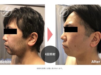 グリッター(glitter)/