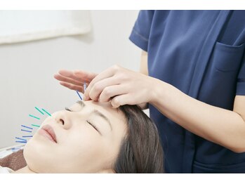 蒼月(aotsuki)/美容鍼