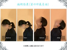 ボディ リセット アンド デザイン(Body Reset & Design)/【施術例】ビフォーアフター