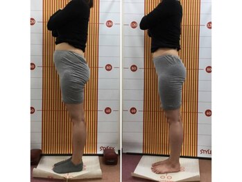 かるむ治療院 浦和店/産後矯正エクササイズ仕上がり