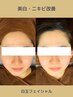 【美白肌】SNSで超話題☆白玉フェイシャル