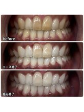 ティースペース(T-space)/極み