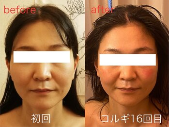 ビーキュート 神戸元町店(BE-CUTE)/コルギ16回目