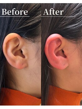 サロン ミモレ 品川高輪(MIMORE)/耳ツボ×リンパ