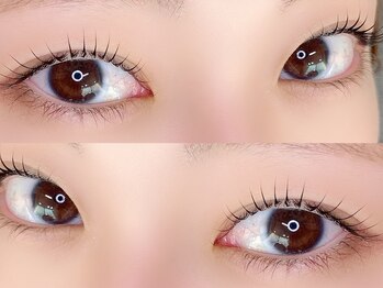 リトマス(LITMUS)/