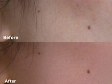 アイロンボーイ(IRONBOY)/艶肌お顔全体WAX