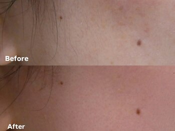 アイロンボーイ(IRONBOY)/艶肌お顔全体WAX