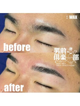 男前倶楽部/脱毛/メンズ脱毛/メンズ専門店