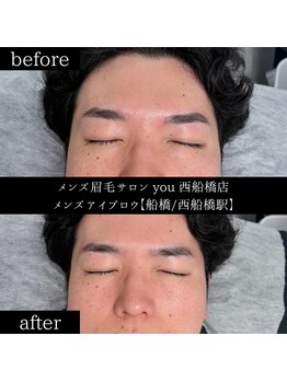 ユー 西船橋店(you)/ビフォーアフター写真