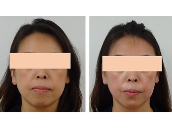 越前屋の写真/冷え・疲れ・たるみが気になる方へ。ラジオ波で深部からじんわり温める温活ケア