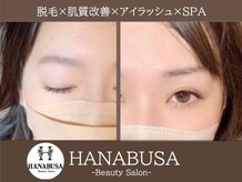 ハナブサ(HANABUSA)