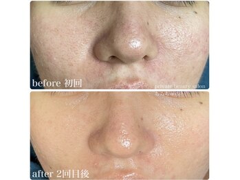 ちらちゅら/クリスティーナ【アンストレス】