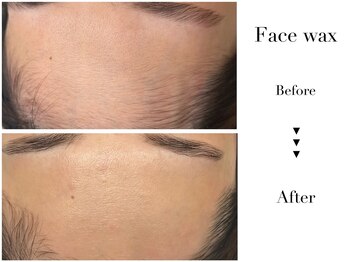 ジル バイ スニップ(Jill by snip)/フェイスワックス(額)