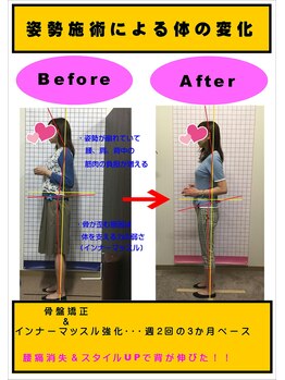 長町バランス整骨院/バランス整骨院の根本施術!!