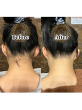 サロンゼロ 池上店(Salon ZERO)/極小ヘッドで繊細うなじデザイン