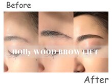 ルル(ruru)/before/after