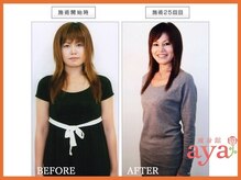 痩身館アヤ(aya)/耳つぼダイエット【富山/痩身】