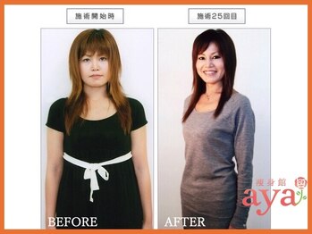 痩身館アヤ(aya)/耳つぼダイエット【富山/痩身】