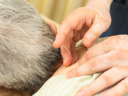 アガペー鍼灸の写真