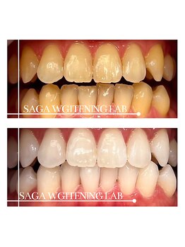 佐賀ホワイトニングラボ/