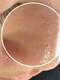 オーガスター(ORGASTAR)の写真/【4月限定☆毛穴リセット】頑固な角栓・皮脂汚れを徹底洗浄！美容成分でキュッと引き締め、滑らか素肌へ☆