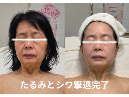 オレオマ(OLEOMA)の写真
