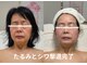 オレオマ(OLEOMA)の写真