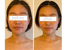 パル コルギサロン(Pal. Korugi salon)/コルギビフォーアフター