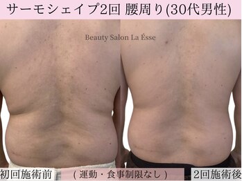ラエッセ(La Esse)/落としにくい腰回りもスッキリ