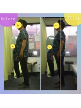 アミーゴ整体院/ビフォーアフター