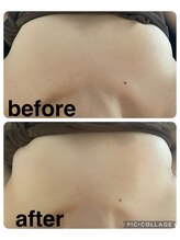 ギンザアール(GINZA R.)/【気になるバストお悩みに】