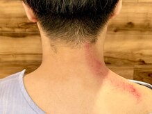 リフージ 大岡山院(RE.FUGE)/スマートツール使用後