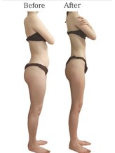 リカバリー(&recovery)/ダイエットrecovery/骨洗浄