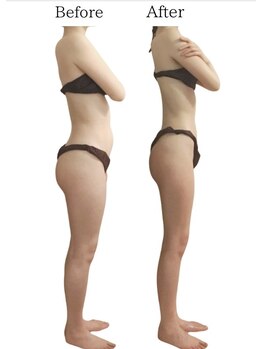 リカバリー(&recovery)/ダイエットrecovery/骨洗浄