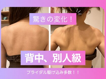 ビボーン ボディ(美bone body)の写真