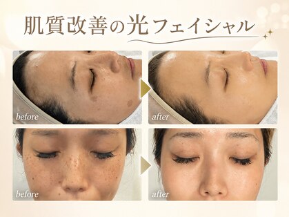 サロンピュア 所沢店の写真