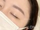 ロナ(LONA)の写真
